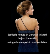 SColioisis Cure